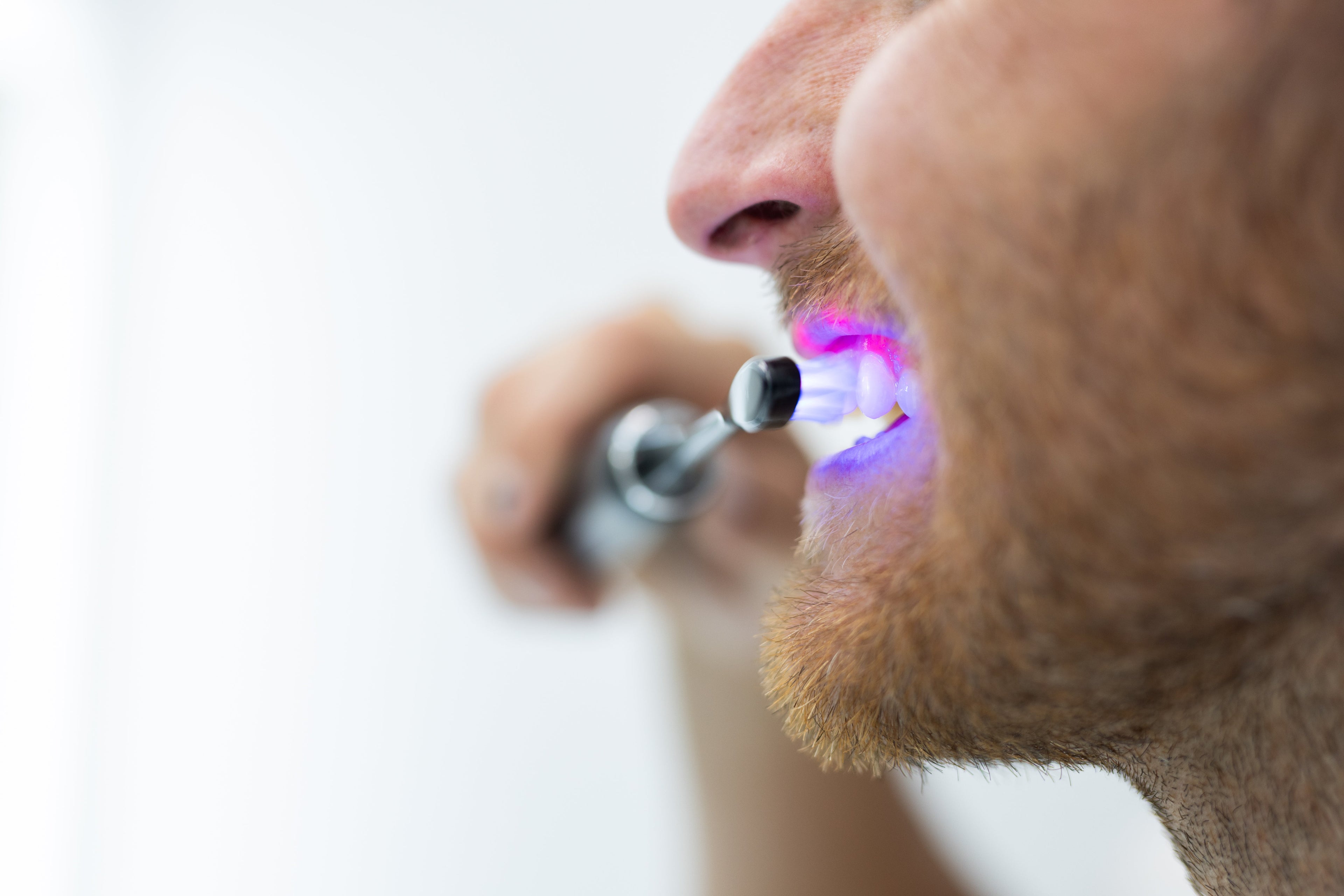 Illume Premium Blue & Red Light-Enhanced Sonic Toothbrush